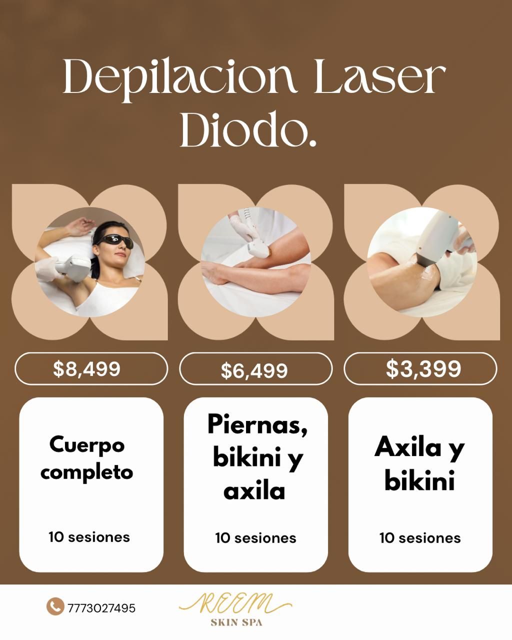 Depilación láser